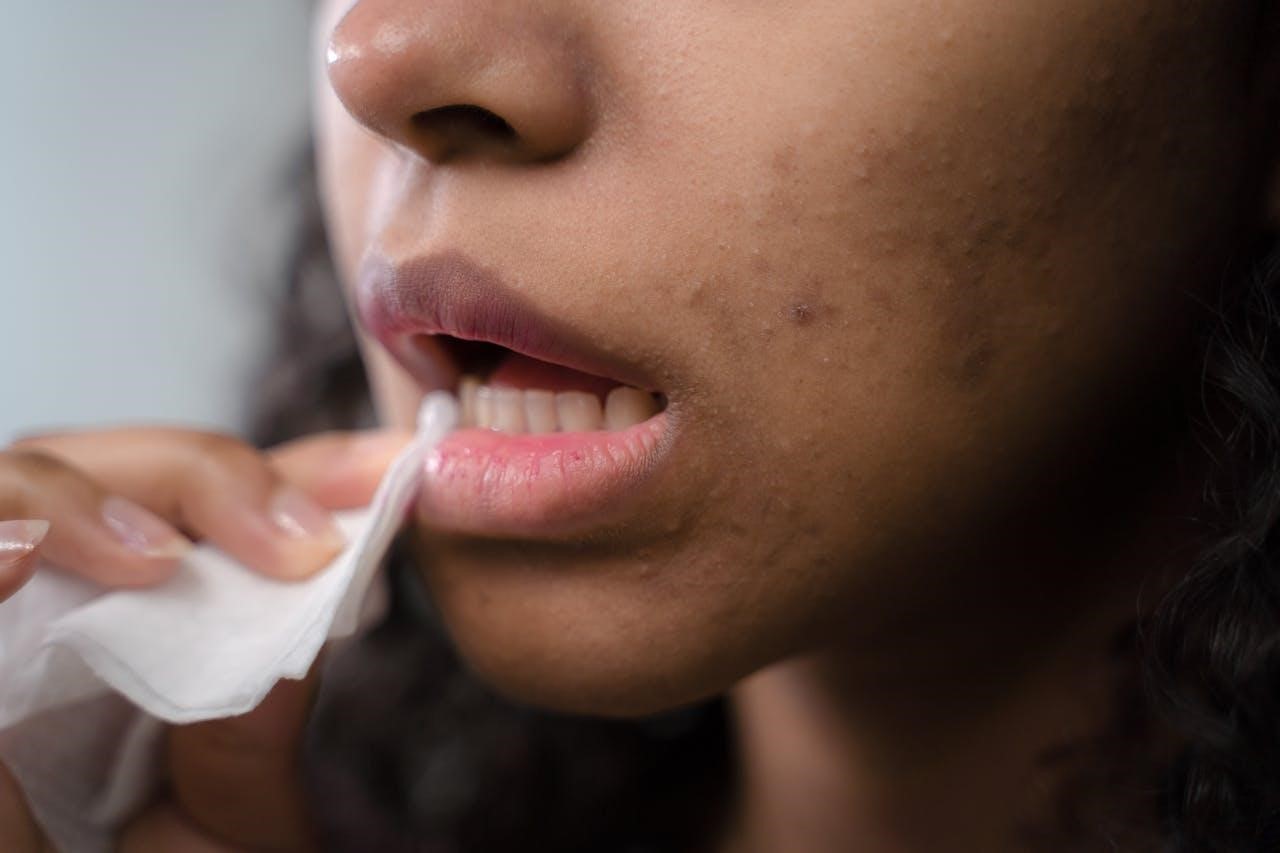 From Acne to Glow: Skincare Transformations & Must-Try Tips